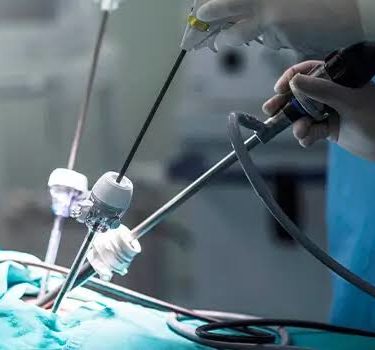 Chirurgie mini-invasive