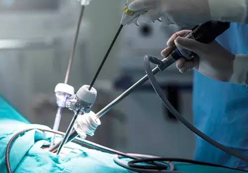 Chirurgie mini-invasive